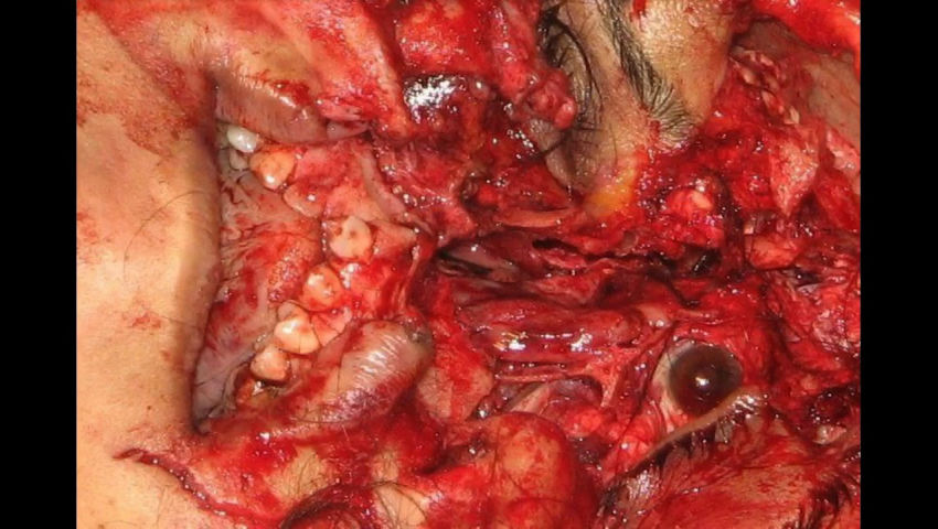 THIRD EYE SIXTH SENSE - GoreSee - Death is Watching over You
